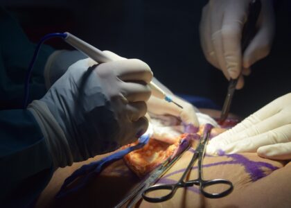 patient on operating table undergoing cospetic surgery